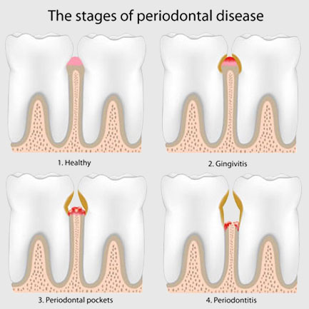 Periodontics
